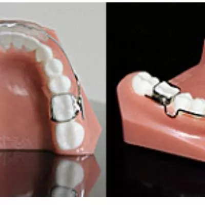 appareil fonctionnel , appareil enfant ,lip bumper, Pornic