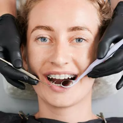 appareil dentaire bagues discrètes céramiques Pornic