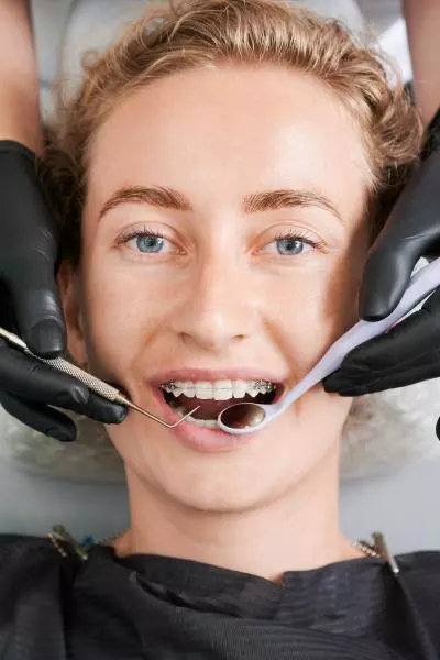 appareil dentaire bagues discrètes céramiques Pornic